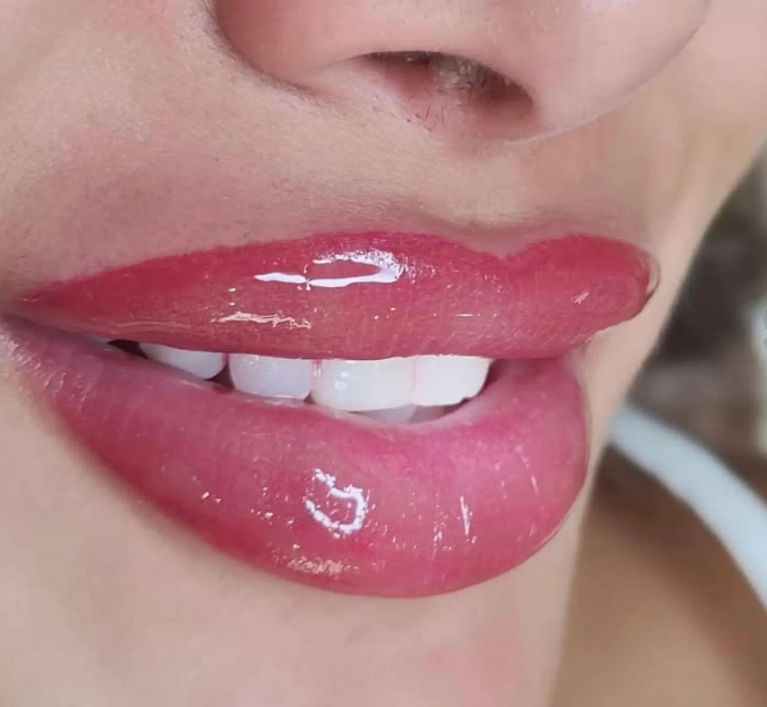 How to Reduce Swelling After Lip Tinting