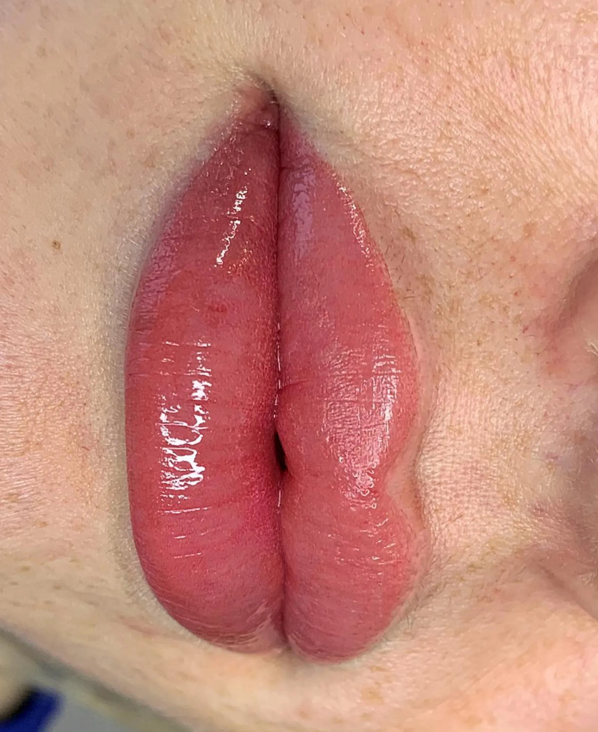 lip tattoo swelling treatment