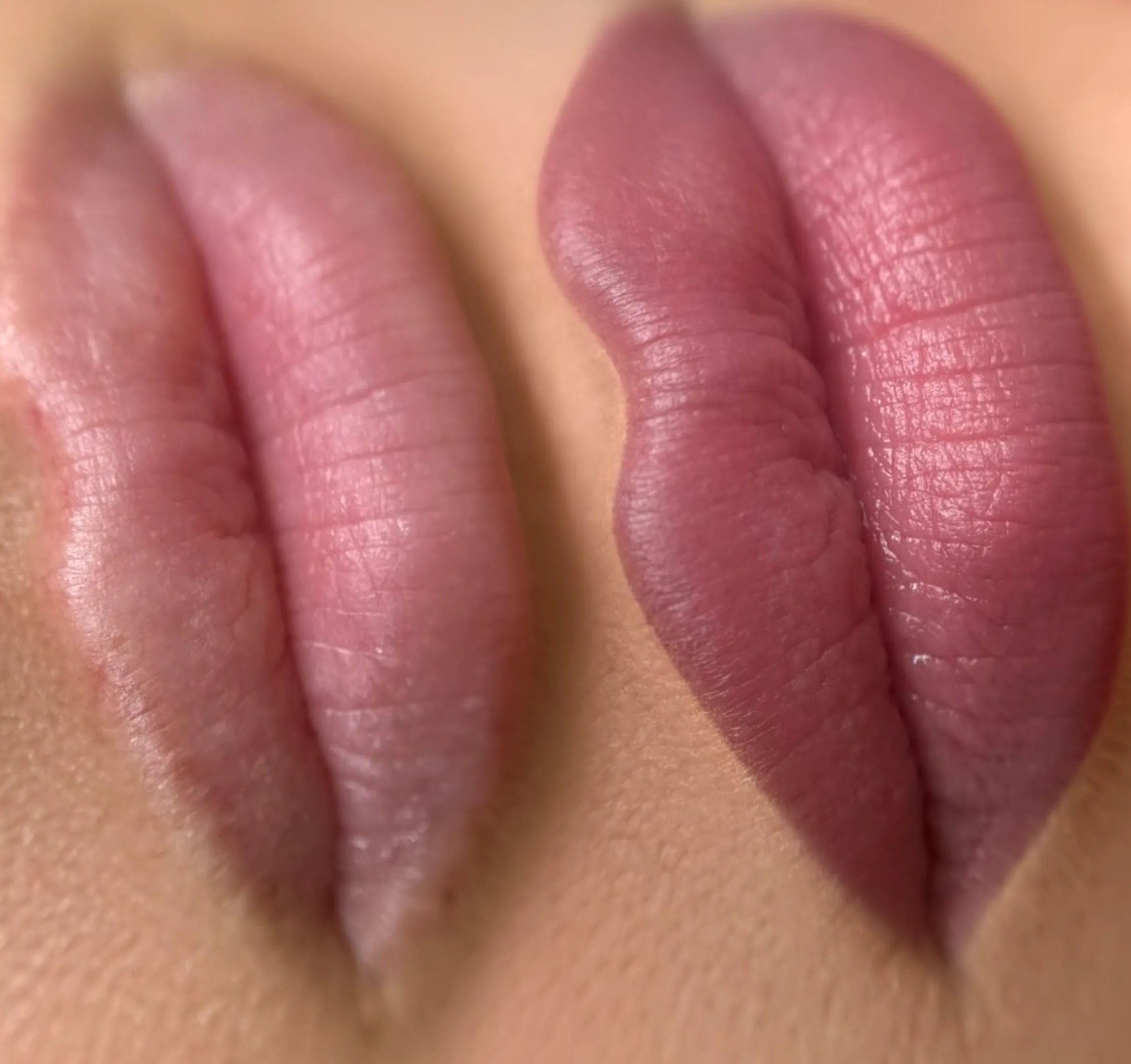 lip neutralisation course